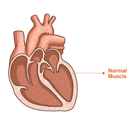 Image of a normal heart muscle