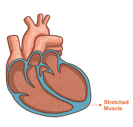 Image of a stretched heart muscle